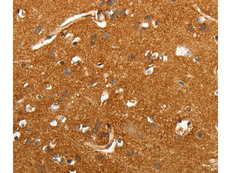 SLC4A4 Polyclonal Antibody Store at -20°C - MSE Supplies LLC