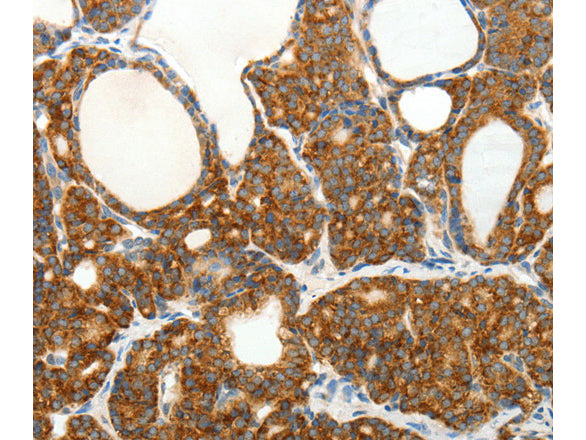 SLC12A4 Polyclonal Antibody Store at -20°C - MSE Supplies LLC