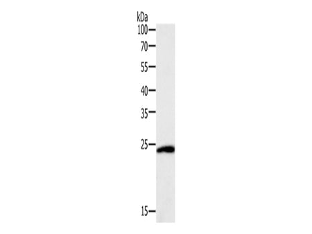 SNAP25 Polyclonal Antibody Store at -20°C - MSE Supplies LLC