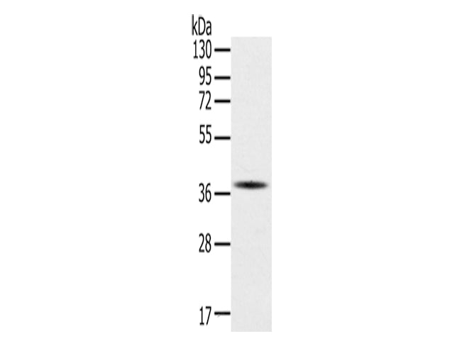 SPARC Polyclonal Antibody Store at -20°C - MSE Supplies LLC