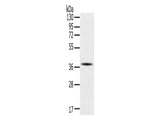 SPARC Polyclonal Antibody Store at -20°C - MSE Supplies LLC