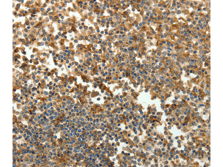 SFTPD Polyclonal Antibody Store at -20°C - MSE Supplies LLC