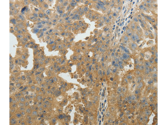 SYT6 Polyclonal Antibody Store at -20°C - MSE Supplies LLC