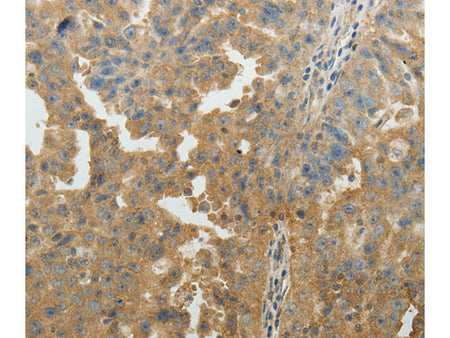 SYT6 Polyclonal Antibody Store at -20°C - MSE Supplies LLC