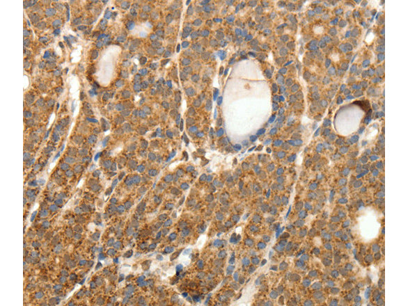 SYT11 Polyclonal Antibody Store at -20°C - MSE Supplies LLC