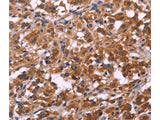 SPATA7 Polyclonal Antibody Store at -20°C - MSE Supplies LLC