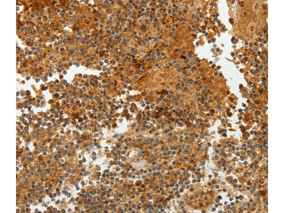 TFF2 Polyclonal Antibody Store at -20°C - MSE Supplies LLC