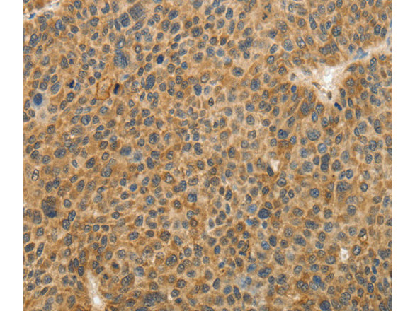 TFPI2 Polyclonal Antibody Store at -20°C - MSE Supplies LLC