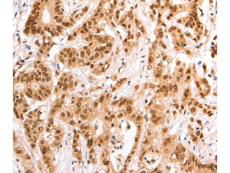 TAX1BP1 Polyclonal Antibody Store at -20°C - MSE Supplies LLC