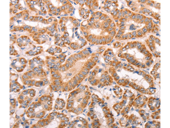 TRPV4 Polyclonal Antibody Store at -20°C - MSE Supplies LLC