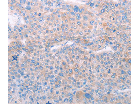 SPATA6 Polyclonal Antibody Store at -20°C - MSE Supplies LLC