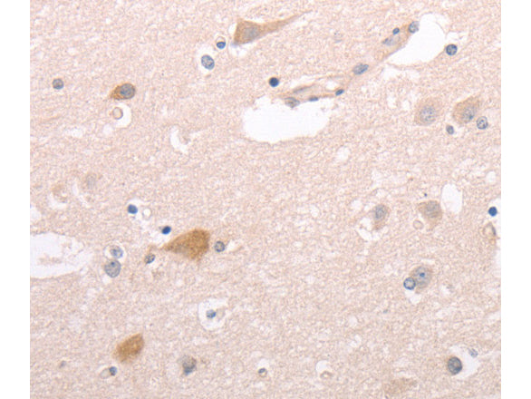 CIDEB Polyclonal Antibody Store at -20°C - MSE Supplies LLC