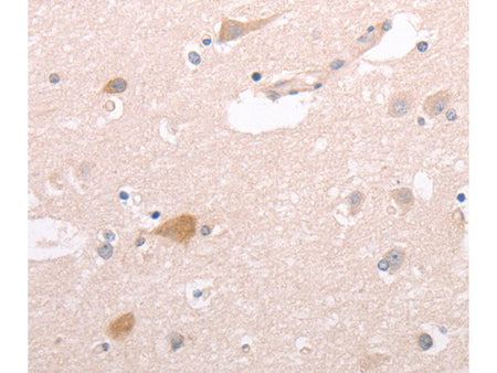 CIDEB Polyclonal Antibody Store at -20°C - MSE Supplies LLC