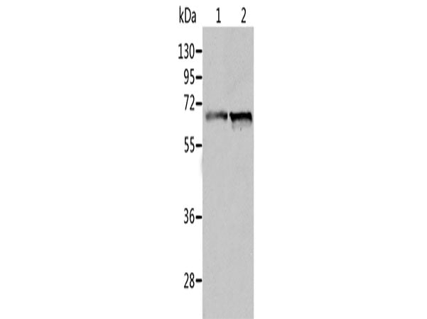 ALDH4A1 Polyclonal Antibody Store at -20°C