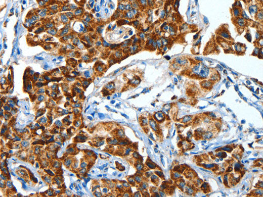 ALDH6A1 Polyclonal Antibody Store at -20°C
