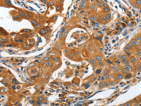 ANAPC10 Polyclonal Antibody Store at -20°C