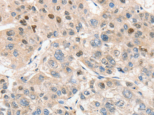 APC5 Polyclonal Antibody
