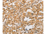 ARMCX1 Polyclonal Antibody Store at -20°C - MSE Supplies LLC
