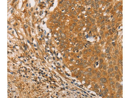 ARMCX3 Polyclonal Antibody Store at -20°C - MSE Supplies LLC