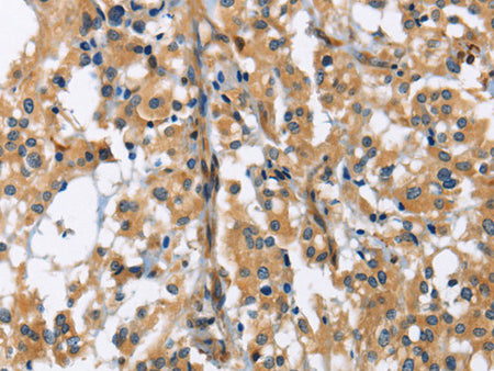 GAB1 Polyclonal Antibody Store at -20°C - MSE Supplies LLC