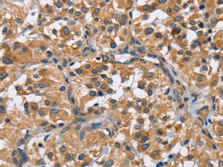 FLT3 Polyclonal Antibody Store at -20°C - MSE Supplies LLC