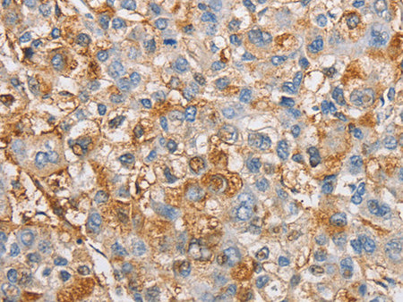 IKK Gamma Polyclonal Antibody Store at -20°C - MSE Supplies LLC