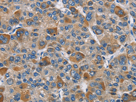 DNMT3A Polyclonal Antibody Store at -20°C - MSE Supplies LLC