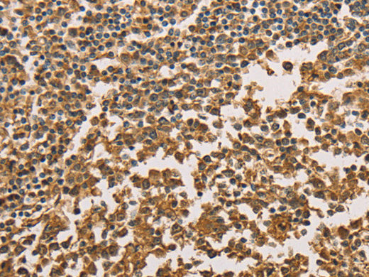 SETD2 Polyclonal Antibody Store at -20°C - MSE Supplies LLC