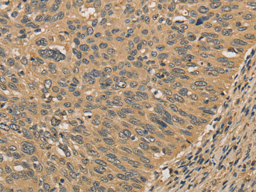 PRDM14 Polyclonal Antibody Store at -20°C - MSE Supplies LLC