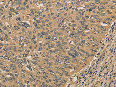 PRDM14 Polyclonal Antibody Store at -20°C - MSE Supplies LLC