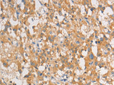 ART3 Polyclonal Antibody Store at -20°C - MSE Supplies LLC