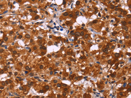 ART5 Polyclonal Antibody Store at -20°C - MSE Supplies LLC