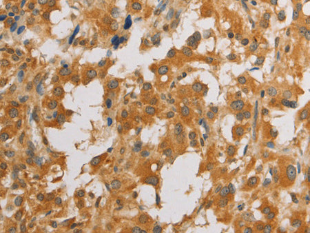 ATG4D Polyclonal Antibody Store at -20°C - MSE Supplies LLC