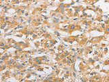 TLR5 Polyclonal Antibody Store at -20°C - MSE Supplies LLC
