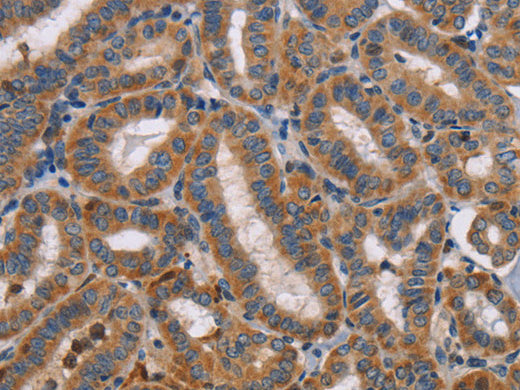 TLR8 Polyclonal Antibody Store at -20°C - MSE Supplies LLC
