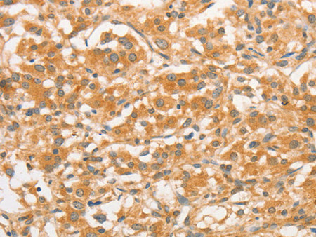 TLR3 Polyclonal Antibody Store at -20°C - MSE Supplies LLC
