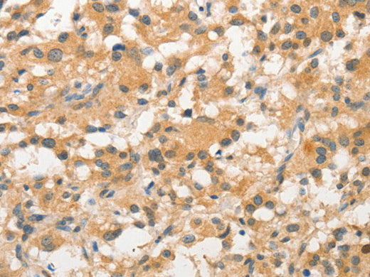 STAM Polyclonal Antibody Store at -20°C - MSE Supplies LLC