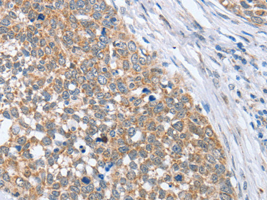 PAPSS1 Polyclonal Antibody Store at -20°C - MSE Supplies LLC
