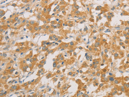 ZWINT Polyclonal Antibody Store at -20°C - MSE Supplies LLC