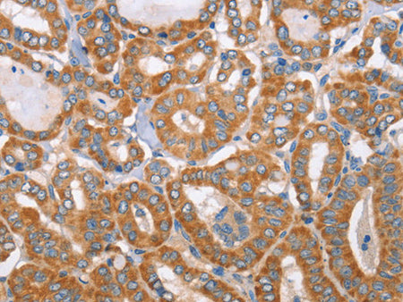MTMR7 Polyclonal Antibody Store at -20°C - MSE Supplies LLC