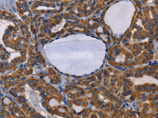 GRK3 Polyclonal Antibody Store at -20°C - MSE Supplies LLC