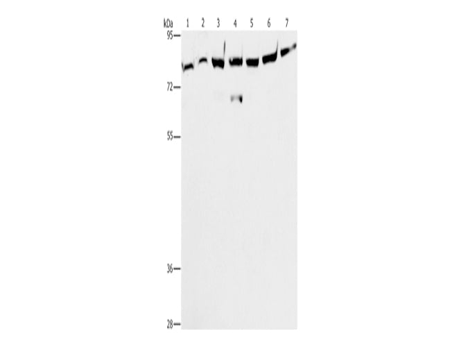 PKC Epsilon Polyclonal Antibody Store at -20°C - MSE Supplies LLC
