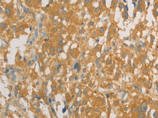 PRPSAP1 Polyclonal Antibody Store at -20°C - MSE Supplies LLC