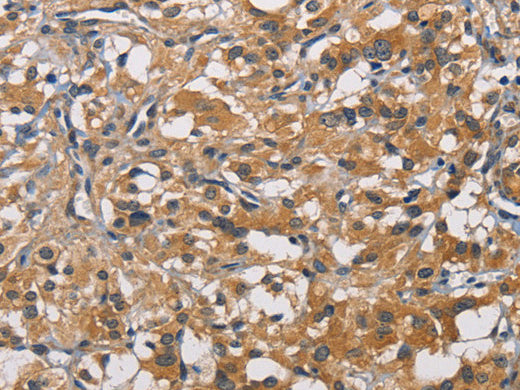 PIKFYVE Polyclonal Antibody Store at -20°C - MSE Supplies LLC