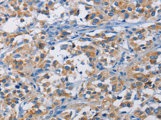 RICTOR Polyclonal Antibody Store at -20°C - MSE Supplies LLC
