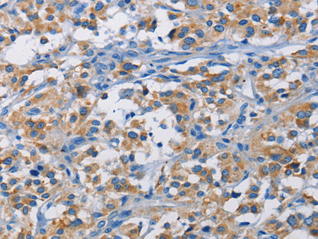 RICTOR Polyclonal Antibody Store at -20°C - MSE Supplies LLC
