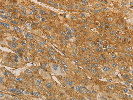 VTN Polyclonal Antibody Store at -20°C - MSE Supplies LLC