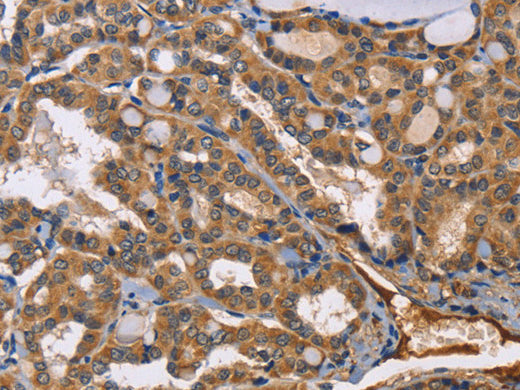 EPHB6 Polyclonal Antibody Store at -20°C - MSE Supplies LLC