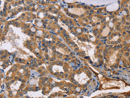EPHB6 Polyclonal Antibody Store at -20°C - MSE Supplies LLC