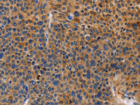 MUSK Polyclonal Antibody Store at -20°C - MSE Supplies LLC